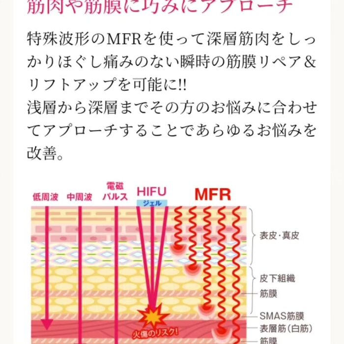 画像303