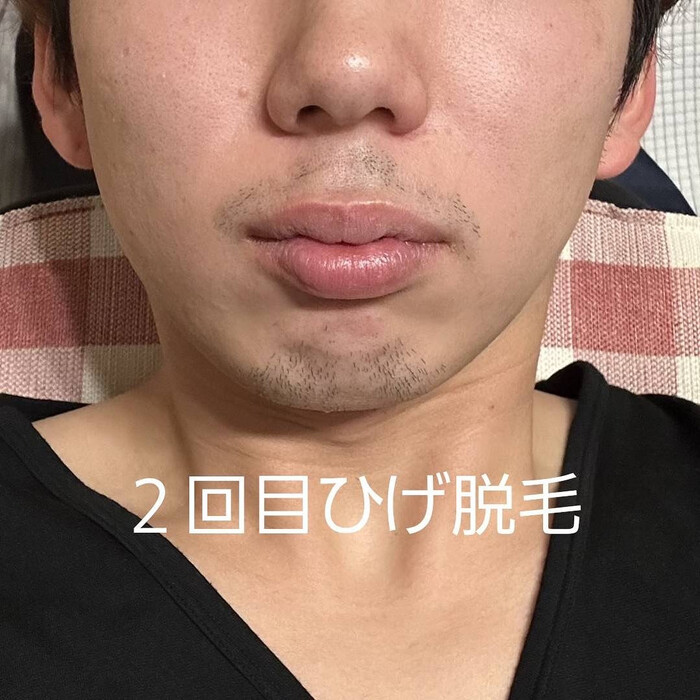 画像371
